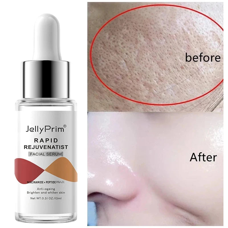 Niacinamide Whitening Serum Facial Whitening Moisturising Hyaluronic Acid Remove Dark Spots Acne Pockmarks Acne Pits Skin Care