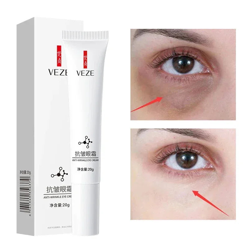 Niacinamide Eye Cream Diminish Dark Circles Eliminate Puffiness Hyaluronic Acid Moisturising Serum for Eyes Anti-PuffinessEyeGel