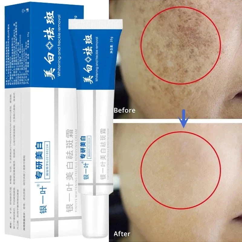 Whitening Blemish Cream Effectively Removes Yellow Spots Melanin Whitens Moisturises The Skin Brightens Face Face Cream 2024