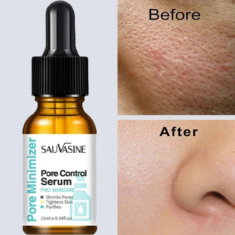 Pore Minimising Essence Reducing Pores Preventing Enlarged Pores Refining Skin Repairing Facial Skin Moisturising Skin Care